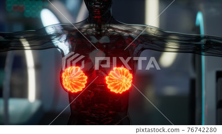 medical scan of Woman Breast 76742280