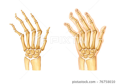 手和關節炎的解剖 76758010