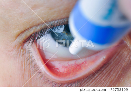 Instill eyedrops or ointment on eye. 76758109