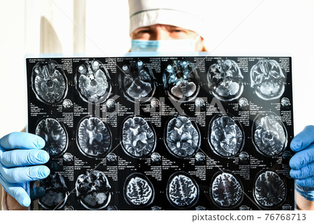 Doctor in protecting gloves holding brain MRI in medical office. MRI scan of human head in clinic. Doctor in protecting gloves holding brain MRI in medical office. MRI scan of human head in clinic. 76768713