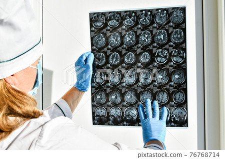 Doctor in protecting gloves holding brain MRI in medical office. MRI scan of human head in clinic. 76768714