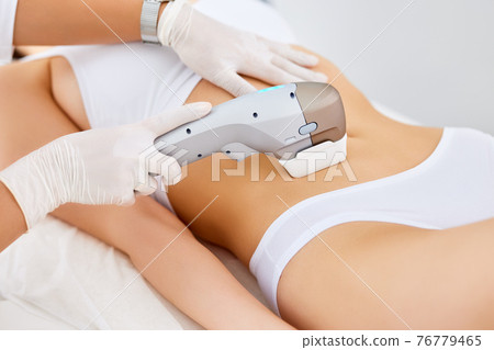Woman getting laser hair removal procedure 76779465
