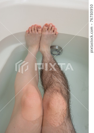 Men's Leg Hair Removal Before & After Image One Leg Only Men's Leg Hair Removal Before & After Image One Leg Only 76780950
