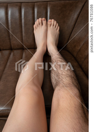 Men's Leg Hair Removal Before & After Image One Leg Only Men's Leg Hair Removal Before & After Image One Leg Only 76781086