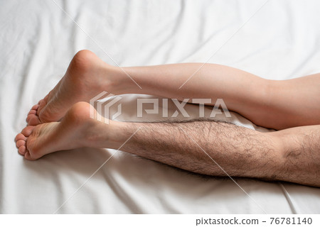 Men's Leg Hair Removal Before & After Image One Leg Only 76781140