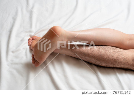 Men's Leg Hair Removal Before & After Image One Leg Only Men's Leg Hair Removal Before & After Image One Leg Only 76781142