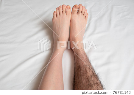 Men's Leg Hair Removal Before & After Image One Leg Only Men's Leg Hair Removal Before & After Image One Leg Only 76781143