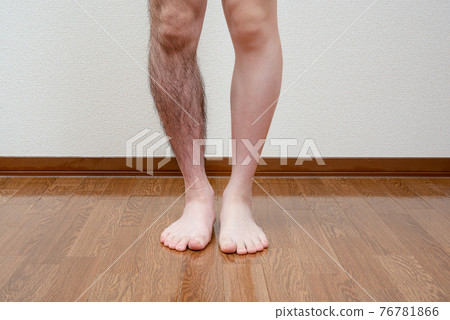 男士腿部脫毛前後圖像單腿 男士腿部脫毛前後圖像單腿 76781866
