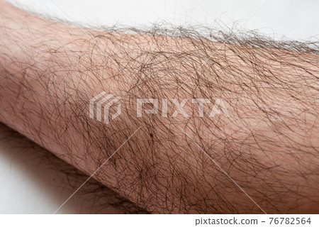 Men's hair removal before image Leg up Men's hair removal before image Leg up 76782564