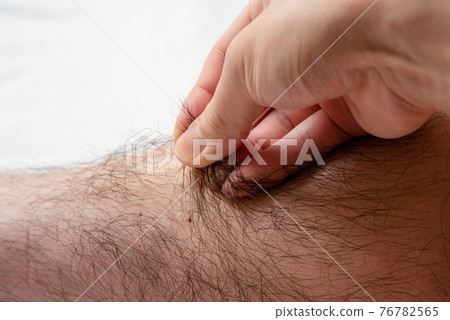 男士脫毛前圖片 Leg up 76782565