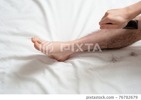 Men's Leg Hair Removal Before & After Image One Leg Only 76782679