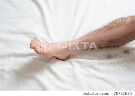 Men's Leg Hair Removal Before & After Image One Leg Only 76782680