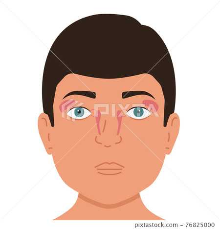 Person and lacrimal gland. Medical vector illustration. Person and lacrimal gland. Medical vector illustration. 76825000