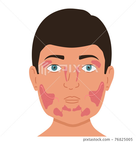 Person with lacrimal and salivary glands. Medical vector illustration. 76825005