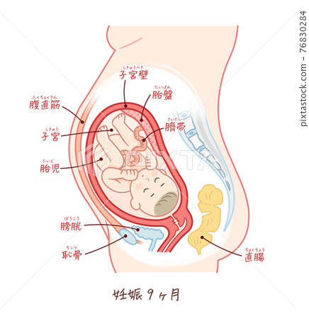 Fetal growth (9 months gestation) with text 76830284