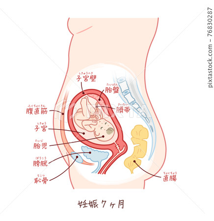 帶有文字的胎兒生長(妊娠7個月) 帶有文字的胎兒生長(妊娠7個月) 76830287