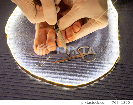 Hands in white sterile gloves file toenails with long pointed file on male toes. 76841890