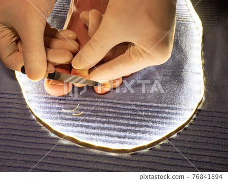 Hands in white sterile gloves file toenails with long pointed file on male toes. 76841894
