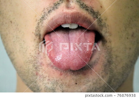 Bearded man with tongue out Bearded man with tongue out 76876938