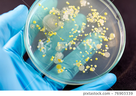 Backgrounds of Characteristics and Different shaped Colony of Bacteria and Mold growing on agar plates from Soil samples for education in Microbiology laboratory. 76903339