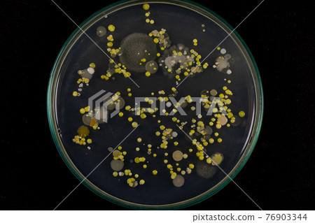 Backgrounds of Characteristics and Different shaped Colony of Bacteria and Mold growing on agar plates from Soil samples for education in Microbiology laboratory. Backgrounds of Characteristics and Different shaped Colony of Bacteria and Mold growing on agar plates from Soil samples for education in Microbiology laboratory. 76903344