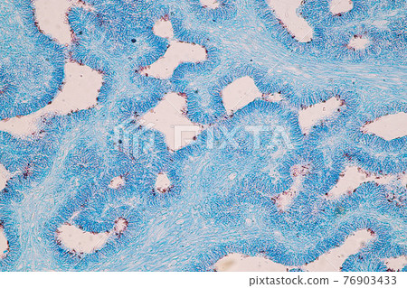 Characteristics of fungi living in wood as a group, are polyphyletic under the microscope for education. Characteristics of fungi living in wood as a group, are polyphyletic under the microscope for education. 76903433