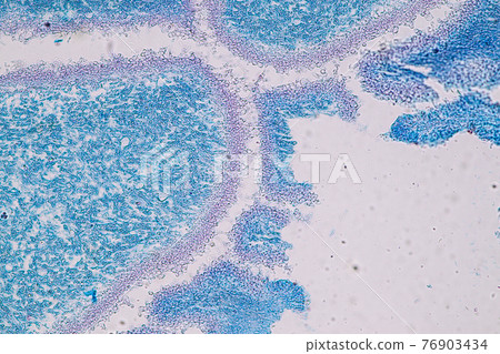 Characteristics of fungi living in wood as a group, are polyphyletic under the microscope for education. Characteristics of fungi living in wood as a group, are polyphyletic under the microscope for education. 76903434