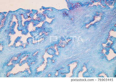 Characteristics of fungi living in wood as a group, are polyphyletic under the microscope for education. Characteristics of fungi living in wood as a group, are polyphyletic under the microscope for education. 76903445