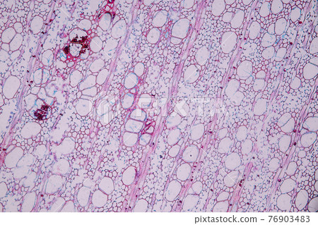 Characteristics of fungi living in wood as a group, are polyphyletic under the microscope for education. Characteristics of fungi living in wood as a group, are polyphyletic under the microscope for education. 76903483