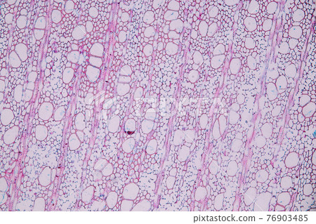 Characteristics of fungi living in wood as a group, are polyphyletic under the microscope for education. Characteristics of fungi living in wood as a group, are polyphyletic under the microscope for education. 76903485