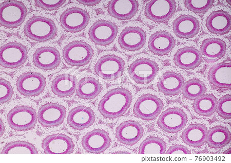 Characteristics of fungi living in wood as a group, are polyphyletic under the microscope for education. 76903492