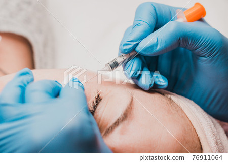 Miliums on the face, removal of hardened and mature milia by a beautician. 76911064
