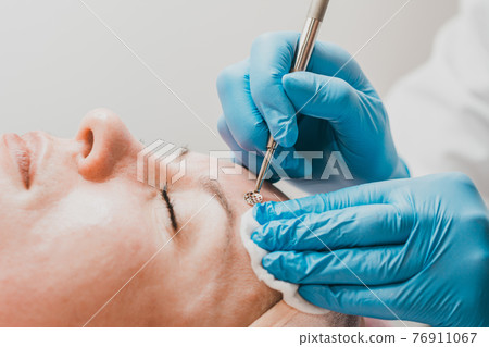 Mechanical facial cleansing, skin cleansing procedure from surface and deep impurities. 76911067