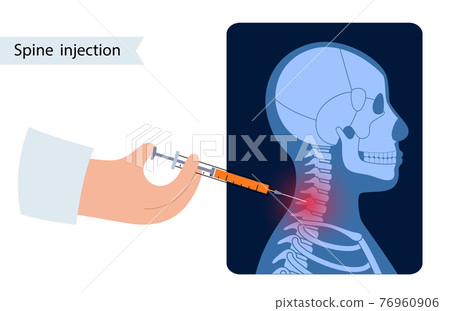 Spine joint injection Spine joint injection 76960906