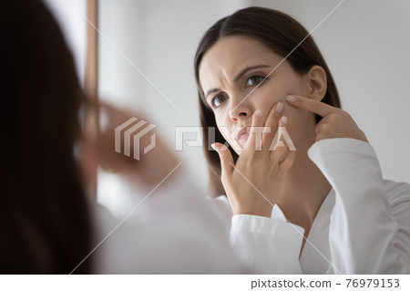 Stressed frowning teenage girl focused on beauty care problem 76979153