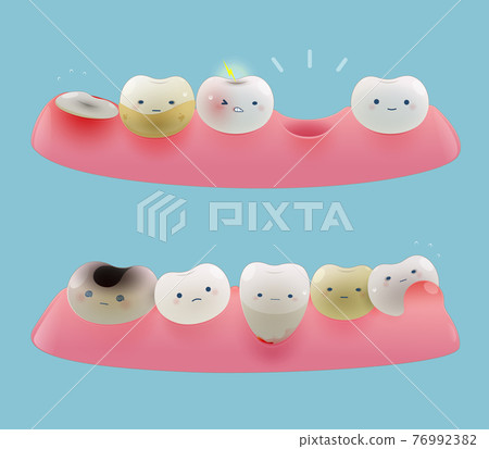 Collection of gum and cute little teeth 76992382