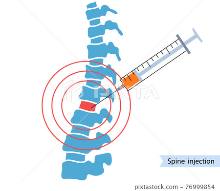 Spine joint injection  76999854
