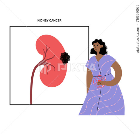 Kidney disease concept 76999863