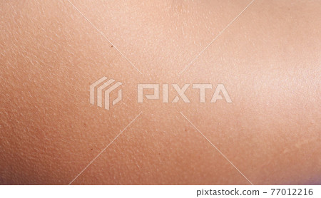 Healthy skin Healthy skin 77012216