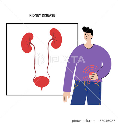 Kidney disease concept 77036027