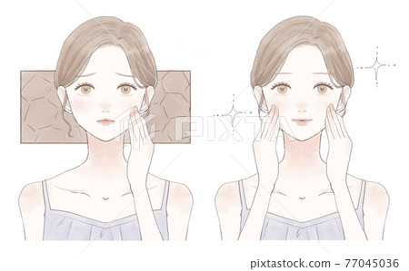 Before and after for women suffering from dry skin Before and after for women suffering from dry skin 77045036