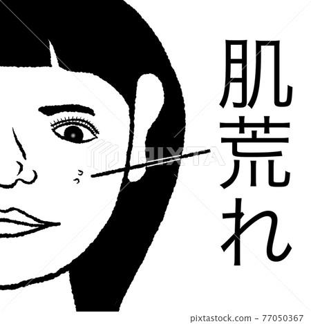 皮膚粗糙 皮膚粗糙 77050367