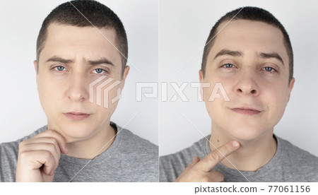 Double chin lift. Before and after plastic surgery, mentoplasty or face-building. Chin fat removal and facial contour correction. Concept of modern medicine and changes in body contours. Facelift Double chin lift. Before and after plastic surgery, mentoplasty or face-building. Chin fat removal and facial contour correction. Concept of modern medicine and changes in body contours. Facelift 77061156
