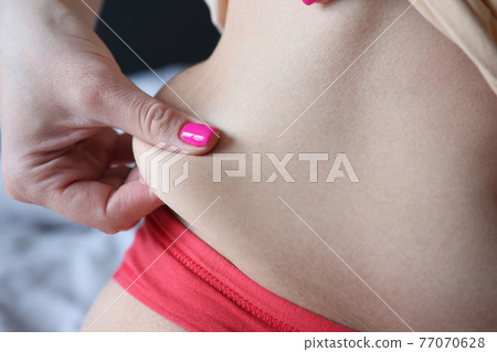 Woman hand wrapping around fat fold on abdomen closeup 77070628
