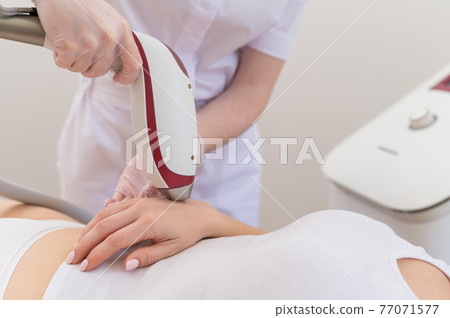Woman on laser epilation procedure. Hardware removal of unwanted vegetation on hands 77071577