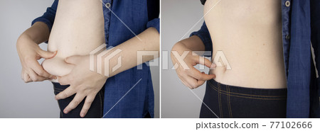 The girl shows the results of work on the body. Before and after a thick and thin waist. In the photo on the left, belly fat is visible. In the photo on the right, a thin waist without extra kilograms The girl shows the results of work on the body. Before and after a thick and thin waist. In the photo on the left, belly fat is visible. In the photo on the right, a thin waist without extra kilograms 77102666
