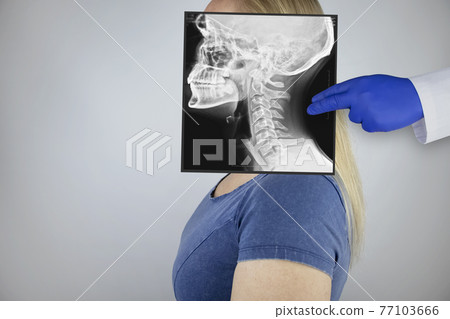 Survey radiography of a woman skull and neck on the side. A doctor radiologist is studying an x-ray examination. A snapshot of the skull is placed on the patient head. Survey radiography of a woman skull and neck on the side. A doctor radiologist is studying an x-ray examination. A snapshot of the skull is placed on the patient head. 77103666