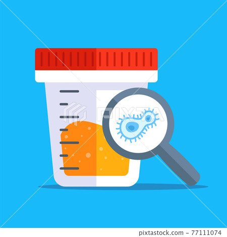 positive result in urine analysis. positive result in urine analysis. 77111074