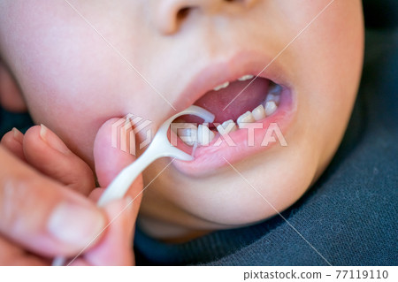 牙縫拉線 兒童 孩子 77119110