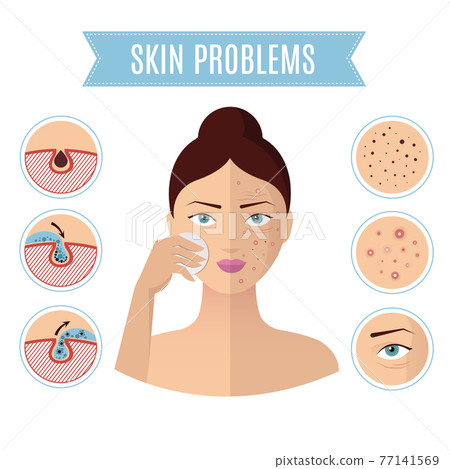 Skin problem solving, acne treatment and cleansing pore for perfect womans face icons 77141569